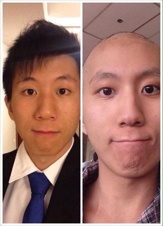 俊培在社交媒體發佈自己的照片，反映出其積極治病的態度與信心。左圖是他患病前，右圖是完成化療後所攝。