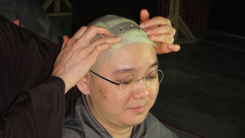 筆者於台灣新營妙禪寺受菩薩戒時頭上燃了三點戒疤(2010)